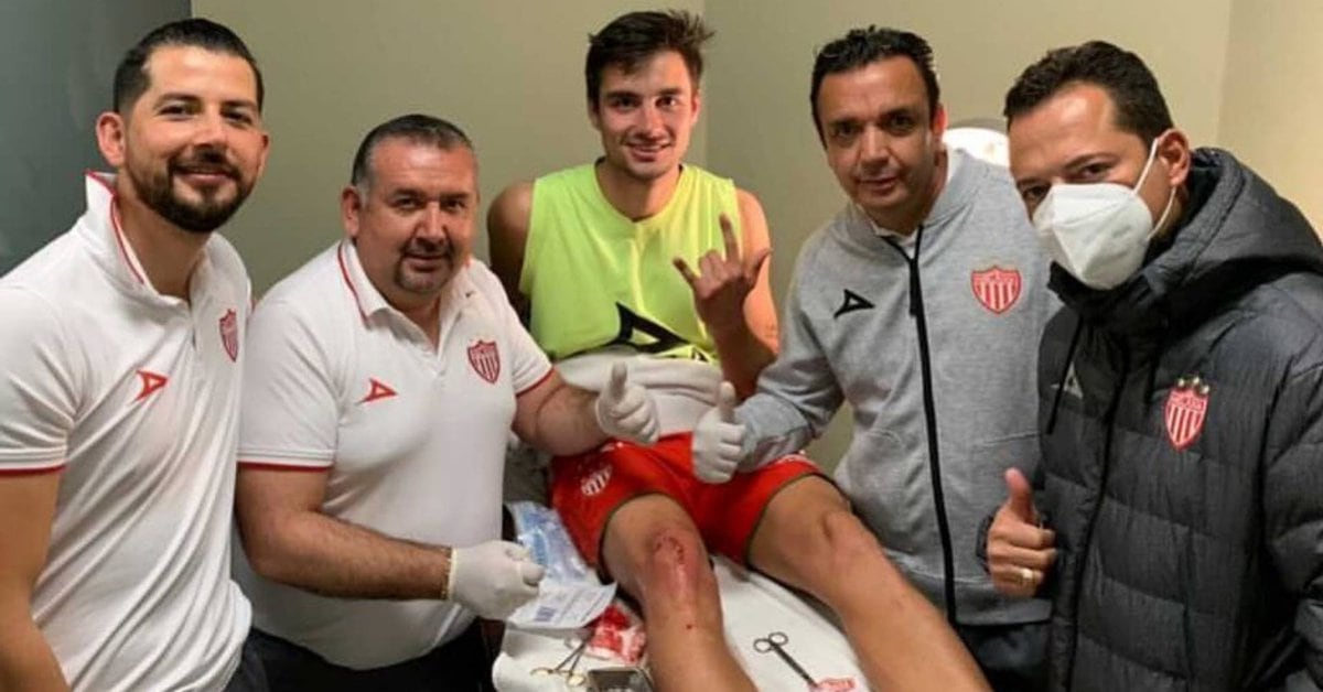 Unai Bilbao was sutured with 12 stitches and there is no date for his return, after being injured by a nail from an advertising banner