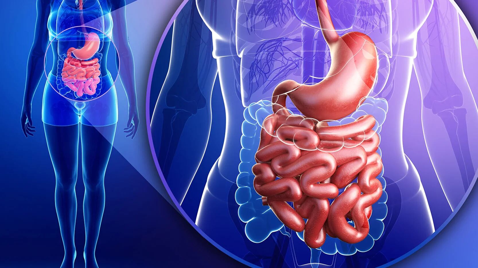 El síndrome de intestino irritable es un trastorno crónico que se caracteriza por malestar abdominal o dolor recurrentes asociados a un hábito intestinal alterado, ya sea estreñimiento, diarrea o ambos (Getty)