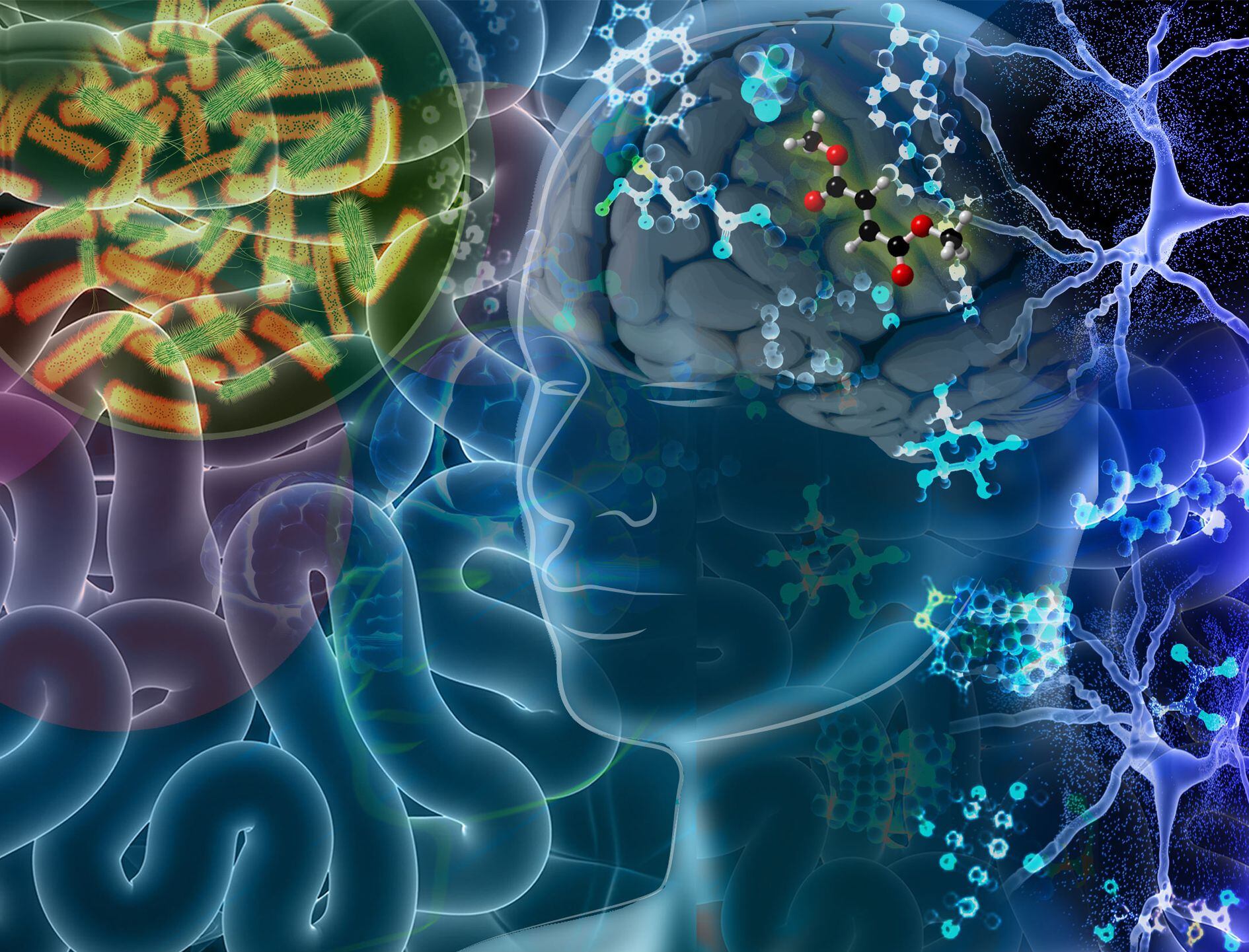 A new study has identified gut-derived metabolites that appear to be neurotoxic and play a role in the progression of multiple sclerosis.  CREDIT Nicoletta Barolini