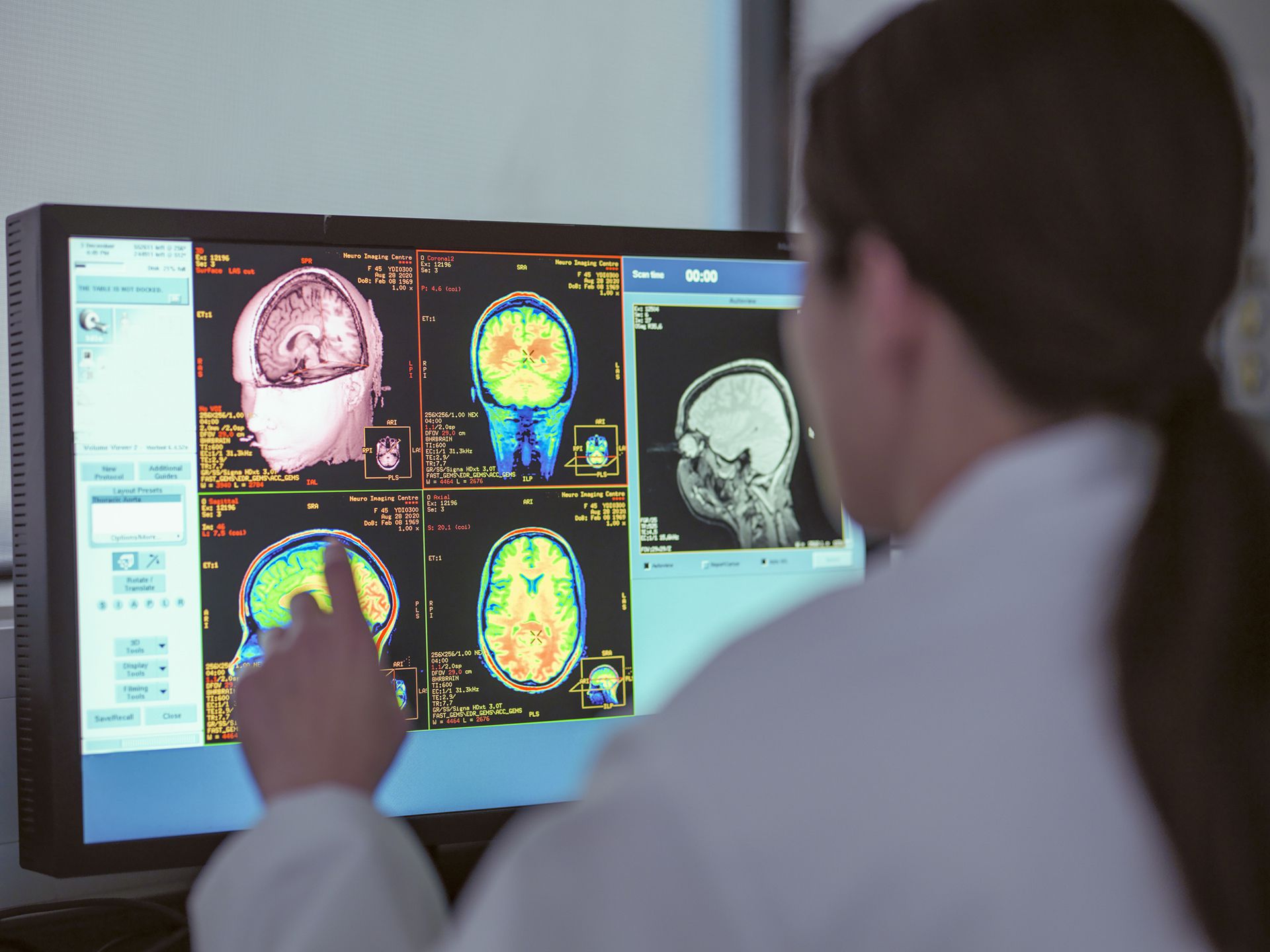 Formación médica adecuada para identificar pacientes con trastorno cognitivo leve y demencia leve de tipo Alzheimer (Getty)