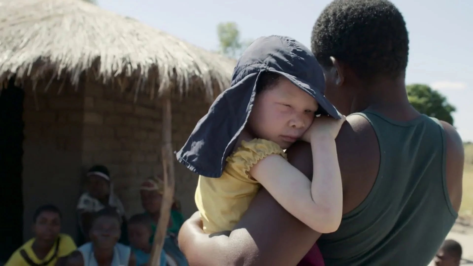 Amnistía Internacional publicó un informe en el que muestra la crueldad contra los albinos en Malawi y en otras zonas de África Central (Amnesty International)