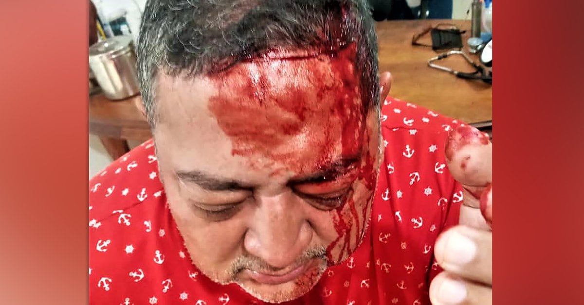 The brutal attack on a doctor from Barinas, Venezuela: “We are from the FBL guerrilla and you cannot be a candidate for mayor”
