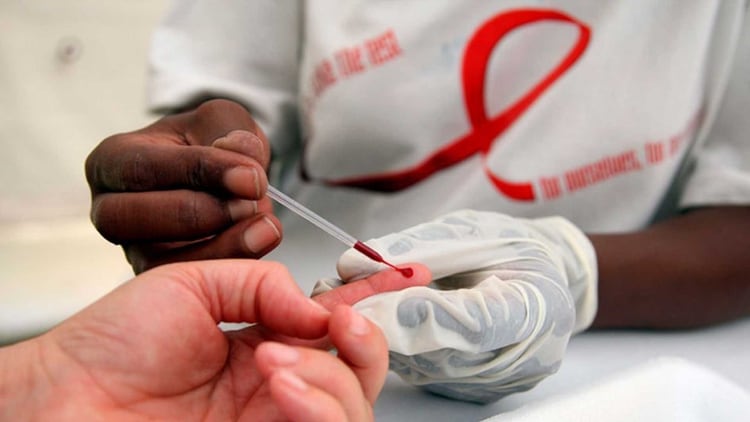 En solo 10 minutos se puede saber si uno posee VIH