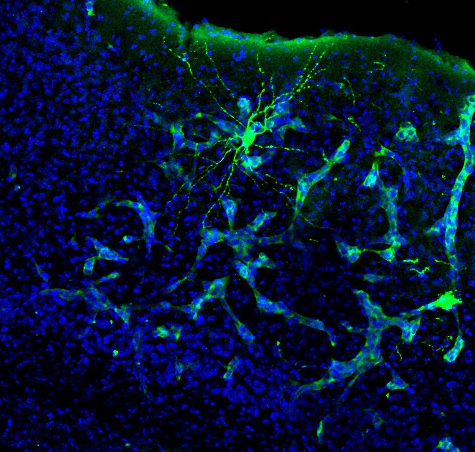 Una imagen de la metástasis en cerebro de ratón. Se aprecia cómo la metástasis (verde más claro) interacciona con una neurona (verde más intenso). Esta neurona está marcada específicamente para su estudio, pero la metástasis está interaccionando con muchas más. (Manuel Valiente/CNIO/EFE)
