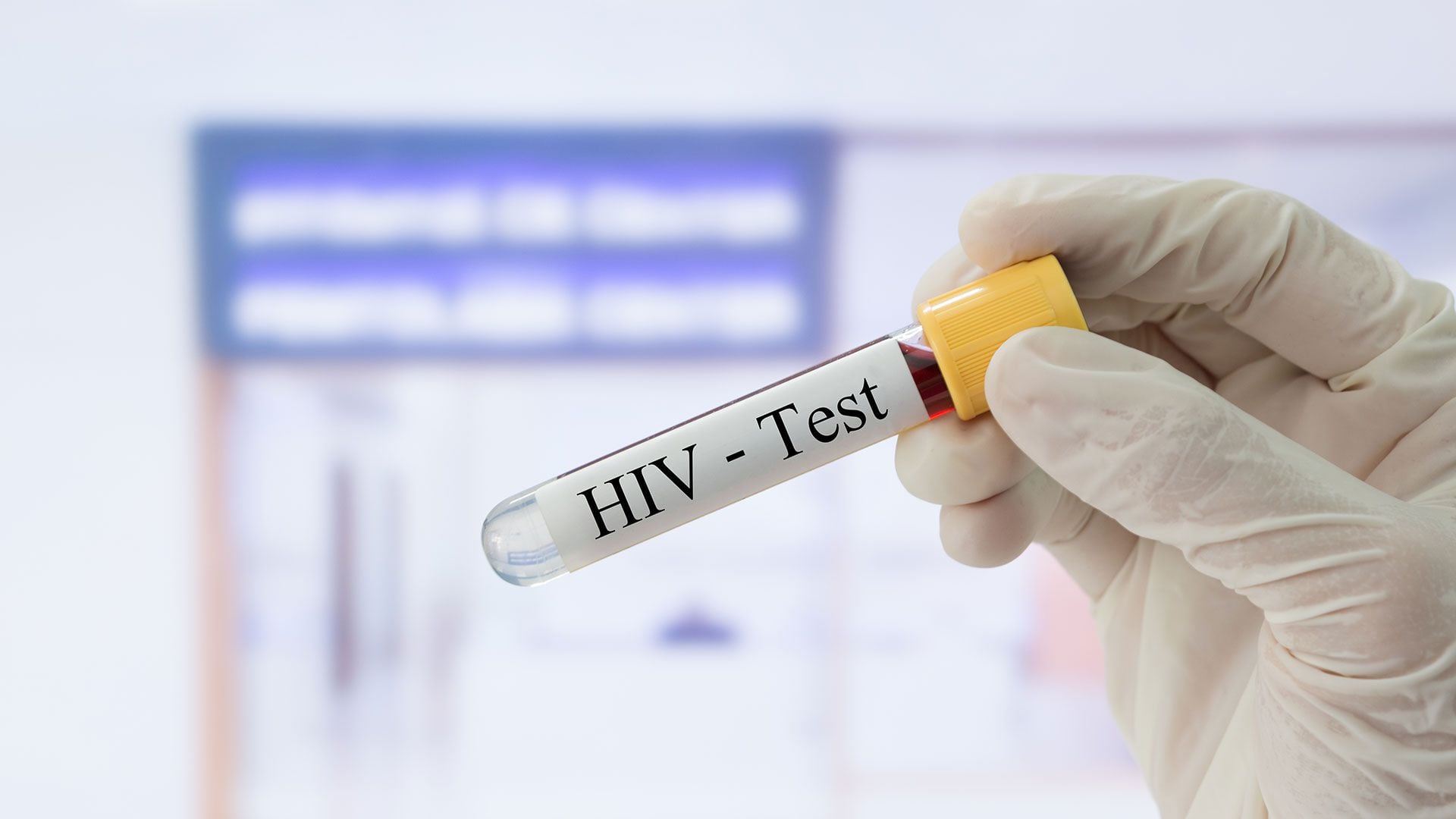 Las pruebas de diagnóstico rápido para el VIH ofrecen resultados el mismo día, facilitando la detección temprana (Getty)
