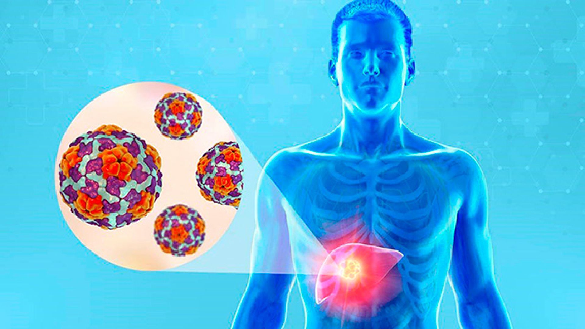 Los síntomas de la hepatitis C pueden incluir: cansancio, fatiga (astenia), náuseas o vómitos, fiebre y escalofríos, orina de color oscuro y materia fecal de color más claro (Foto: UNAM)