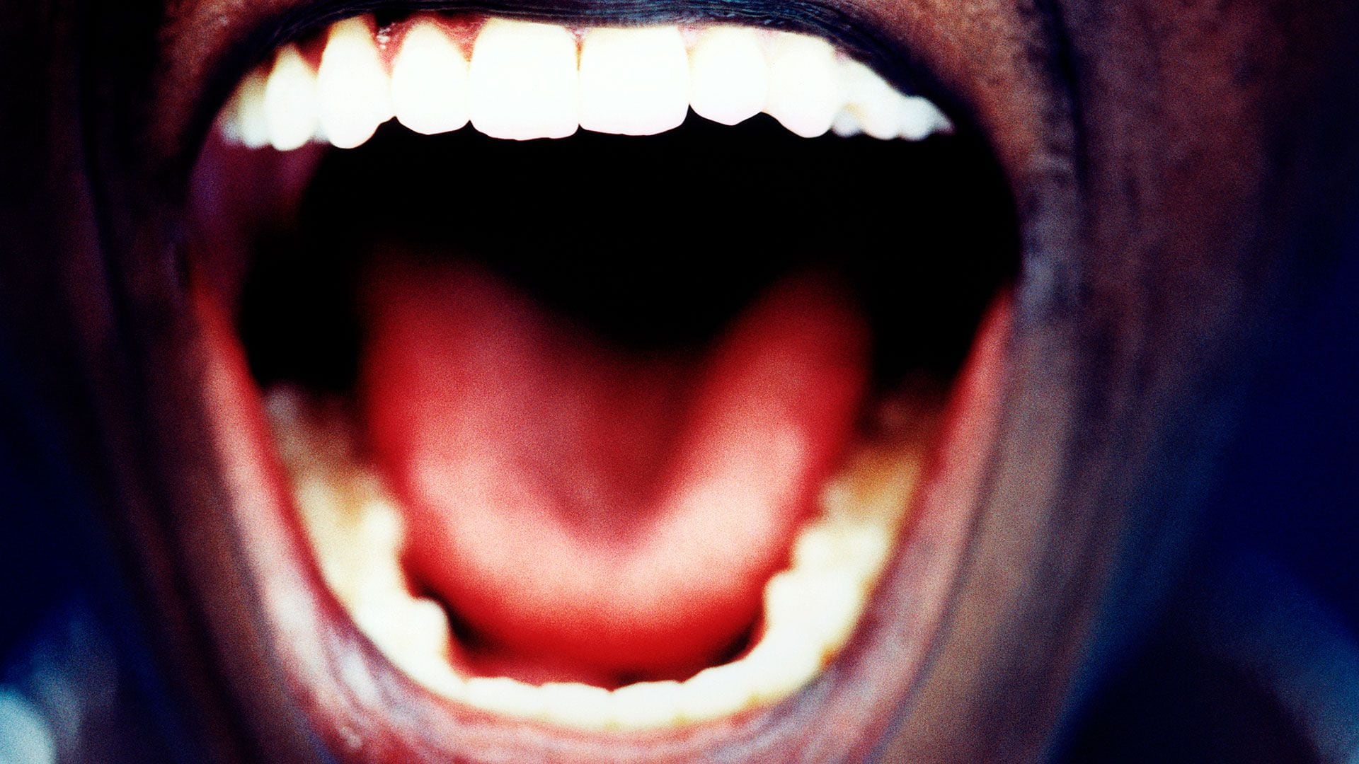 La lengua roja puede ser un síntoma de escarlatina (Gettyimages)