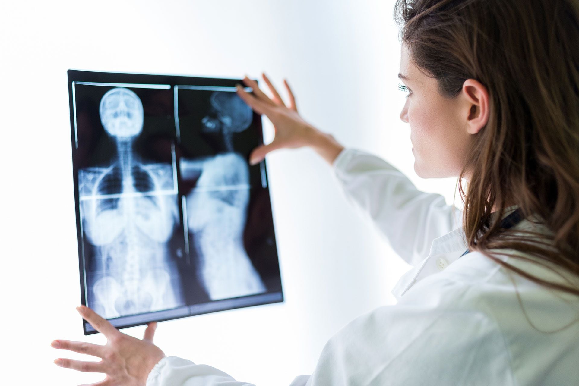 Los resultados provisionales revelan que el cribado con IA detectó un 20% más de cánceres en comparación con la doble lectura rutinaria de las mamografías por dos radiólogos (Getty)