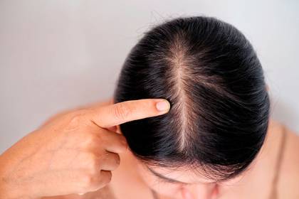 Los shampoo anti caída solamente sirven para fortalecer el cabello (Shutterstock)