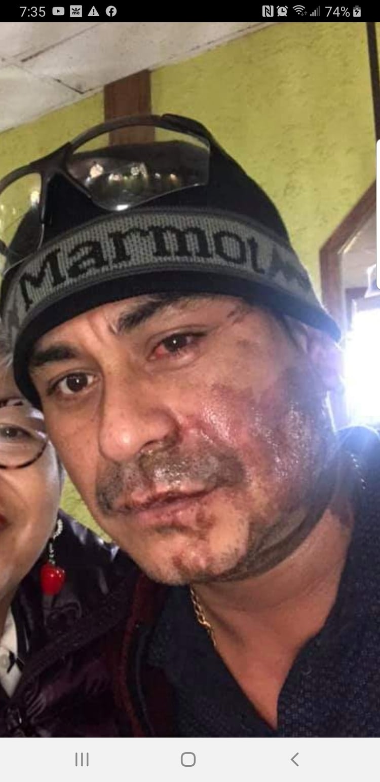 Mahud Villalaz después del ataque (Foto: GoFoundMe)