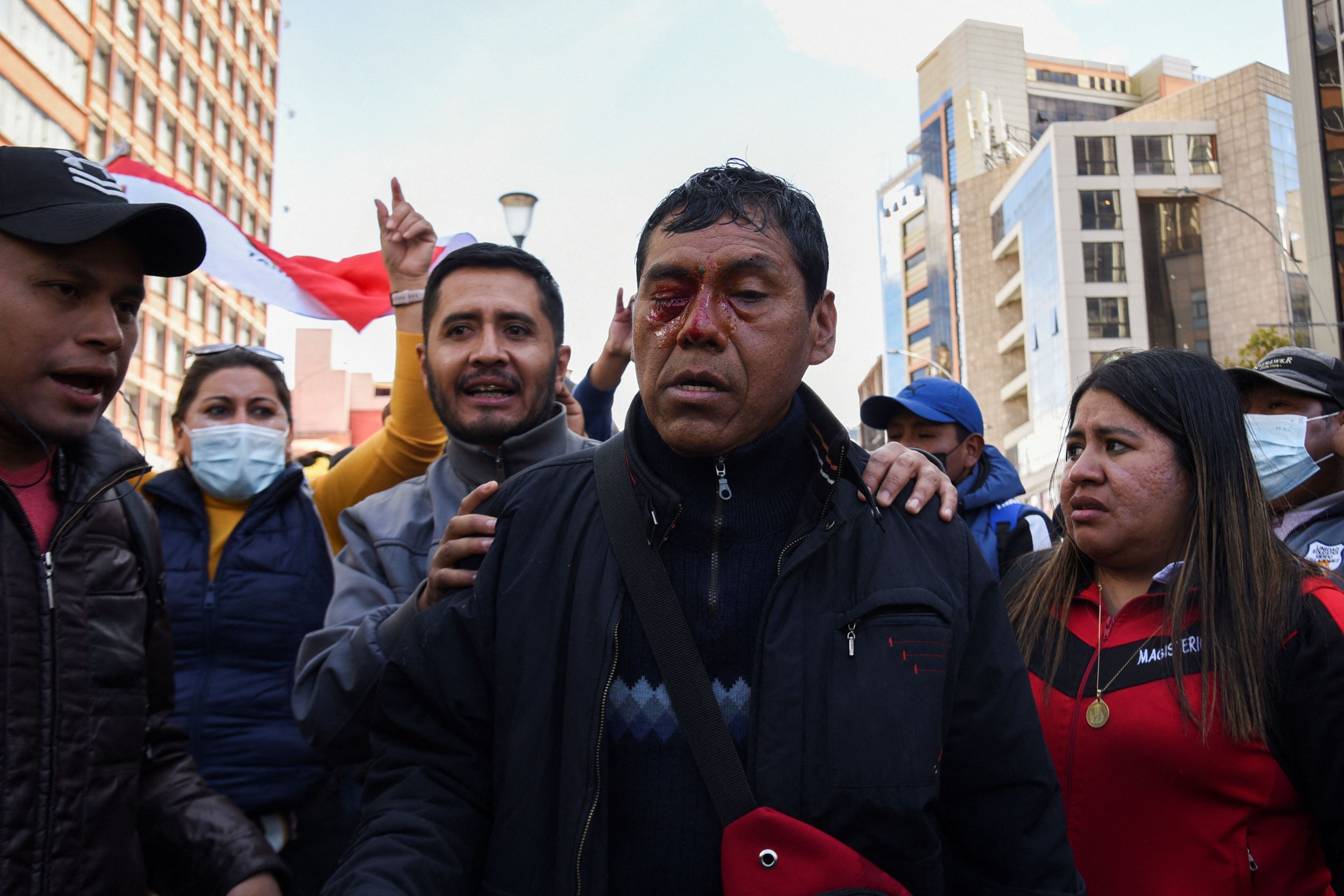 MATERIAL SENSIBLE. Un hombre con sangre en el ojo tras ser alcanzado por una bala de pintura durante una protesta contra los cambios en los planes de estudio educativos, en La Paz, Bolivia, 22 de marzo de 2023. REUTERS/Claudia Morales/Archivo