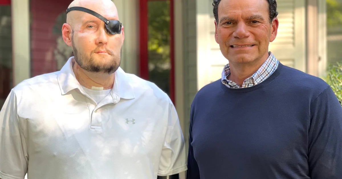 The electrocuted man underwent the first face transplant, including an eye