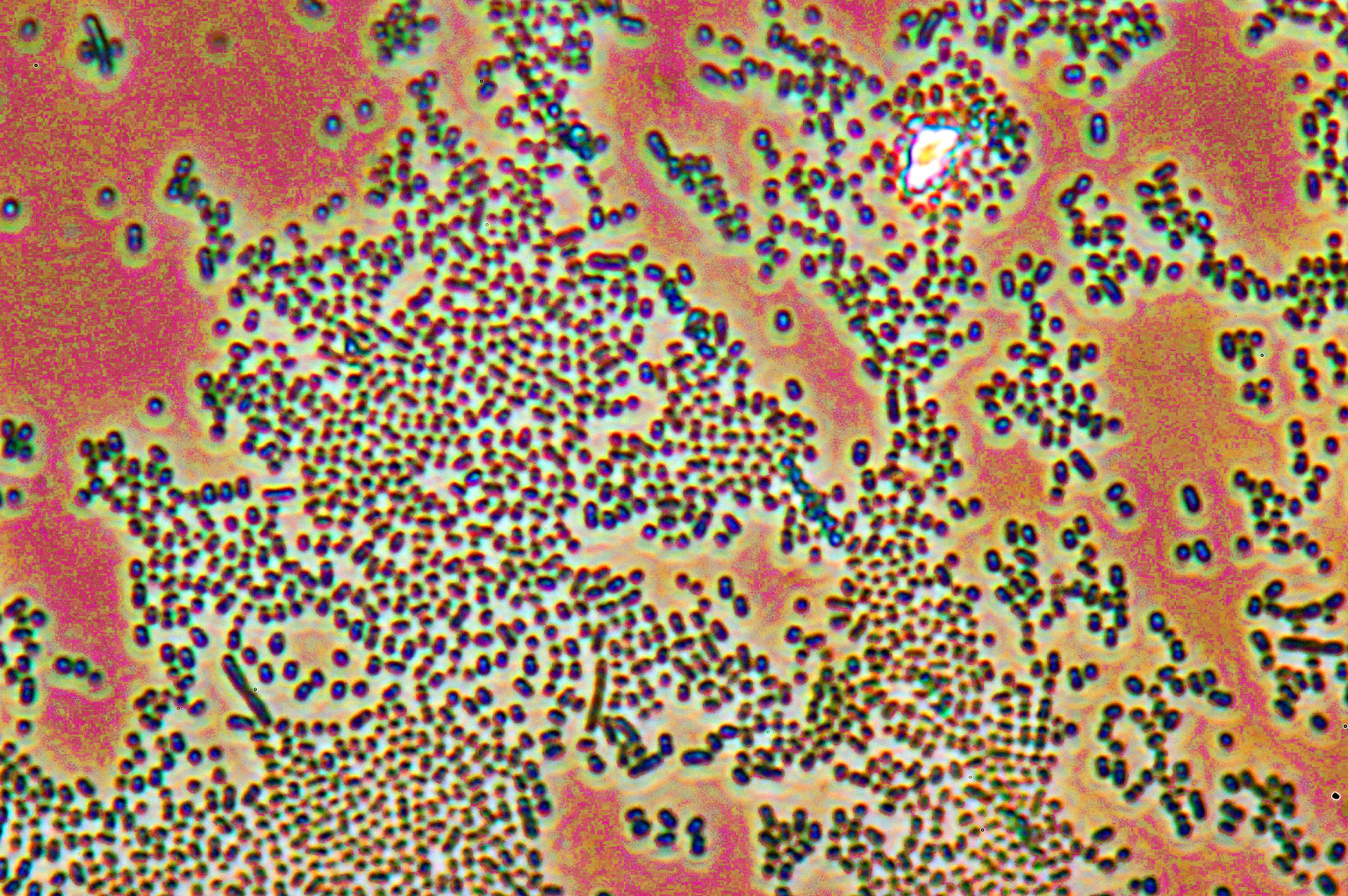 En 2013, se publicaron los resultados del primer ensayo clínico sobre esta técnica, que demostró que era más eficaz que los antibióticos en el tratamiento de las infecciones recurrentes por Clostridium Difficile. Esta bacteria también provoca una de las infecciones nosocomiales más importantes, genera diarrea, y puede poner en peligro la vida del paciente.