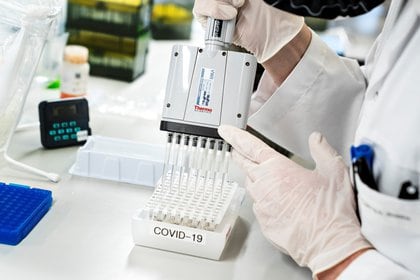 Una persona utiliza equipo de laboratorio mientras los investigadores de la Universidad de Aalborg detectan y analizan todas las muestras positivas de la enfermedad por coronavirus danesa (COVID-19) para la nueva variante del virus inglés "cluster B.1.1.7", en Aalborg, Dinamarca, el 15 de enero de 2021. Ritzau Scanpix / Henning Bagger a través de REUTERS ATENCIÓN A LOS EDITORES: ESTA IMAGEN FUE PROPORCIONADA POR UN TERCERO. DINAMARCA FUERA. NO HAY VENTAS COMERCIALES O EDITORIALES EN DINAMARCA.

