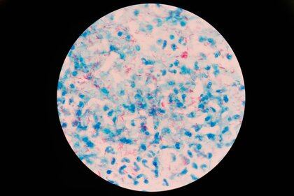La bacteria de la tuberculosis se llama "Bacilo de Koch". Fue descubierta el 24 de marzo de 1882 por Robert Koch, a quien posteriormente se le  otorgó el Premio Nobel de Fisiología o Medicina. 