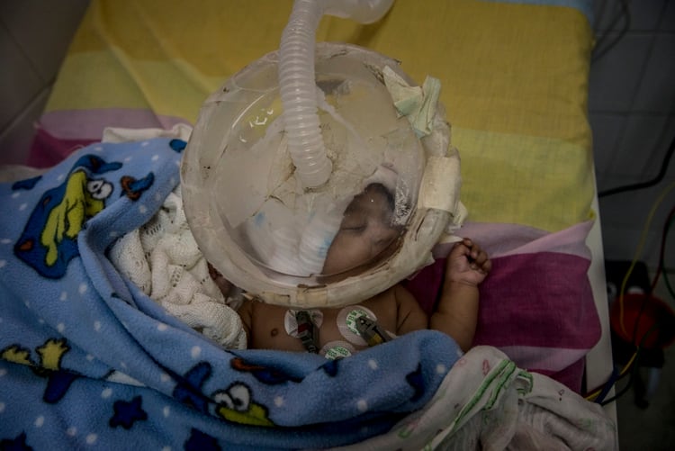Irianny Baute Marín, de dos meses, tiene bronquitis. Sus padres no pudieron encontrar los antibióticos necesarios en Venezuela. (Meridith Kohut/The New York Times)