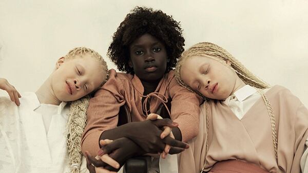 Resultado de imagen para Lara y Mara Bawar, las hermanas albinas que han revolucionado la industria