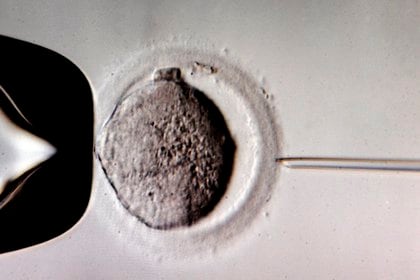 Embrión de células humanas. EPA/WALTRAUDGRUBITZSCH/Archivo

