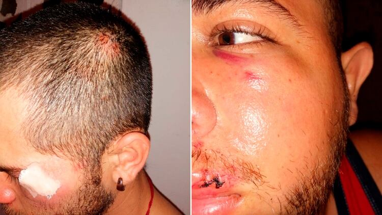 Santiago y Diego Coppens, hermanos de Amaya Coppens, fueron brutalmente golpeados por las turbas sandinistas