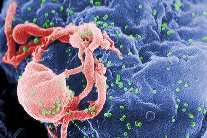Microfotografía de VIH-1 (en verde) en un cultivo de linfocitos. Wikimedia Commons / C. Goldsmith / CDC
