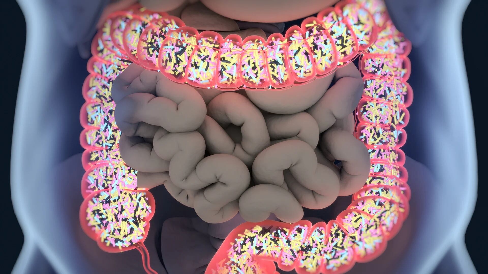 La nueva investigación indagó en que las bacterias intestinales producen sustancias químicas nocivas que pasan a través de fugas en el tejido intestinal envejecido y dañan el resto del cuerpo (iStock)