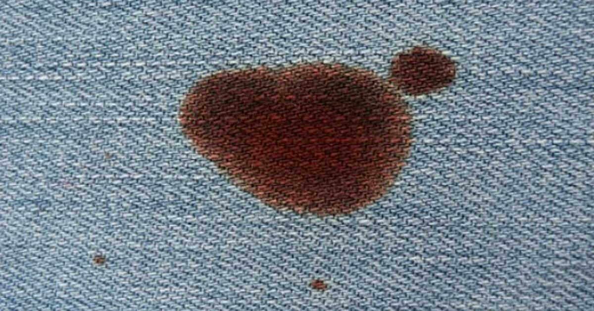 Cómo quitar las manchas de sangre de la ropa, métodos 100% probados efectivos - Infobae