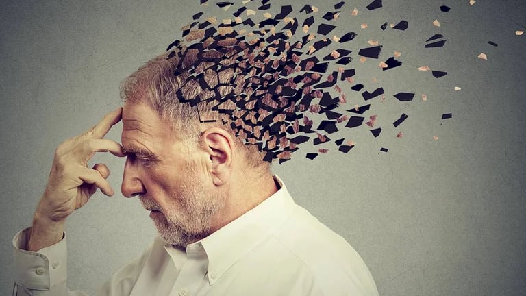  Ilustración de una persona con la enfermedad de Alzheimer.  