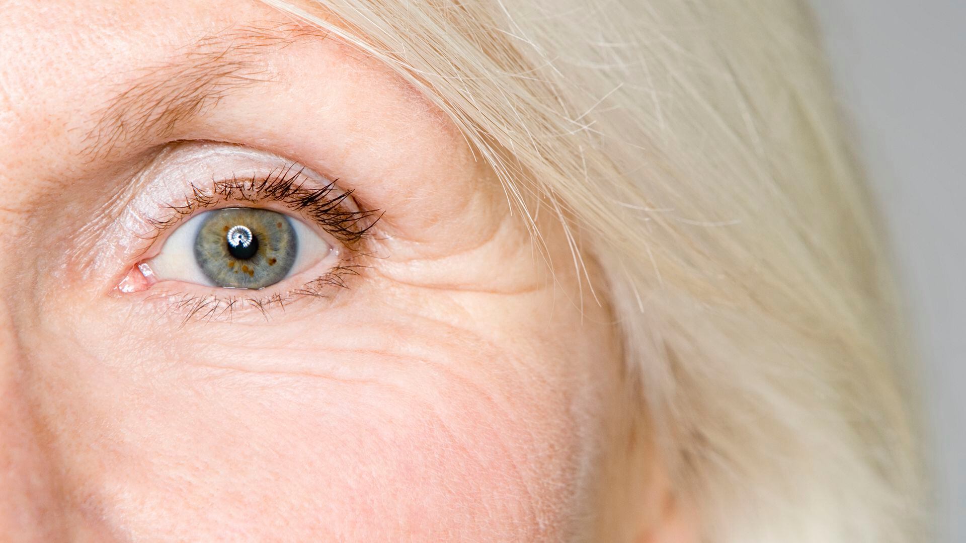 El glaucoma es más frecuente después de los 40 años y mucho más luego de los 70 (Getty)