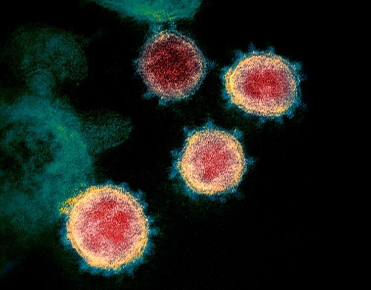 Para infectar una célula, los coronavirus usan una proteína ‘espiga’ que se une a la membrana celular.