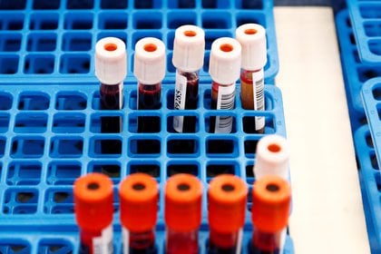 Los médicos han utilizado plasma de convalecencia para tratar pacientes o inmunizar a personas con alto riesgo de exposición al virus (Reuters) 