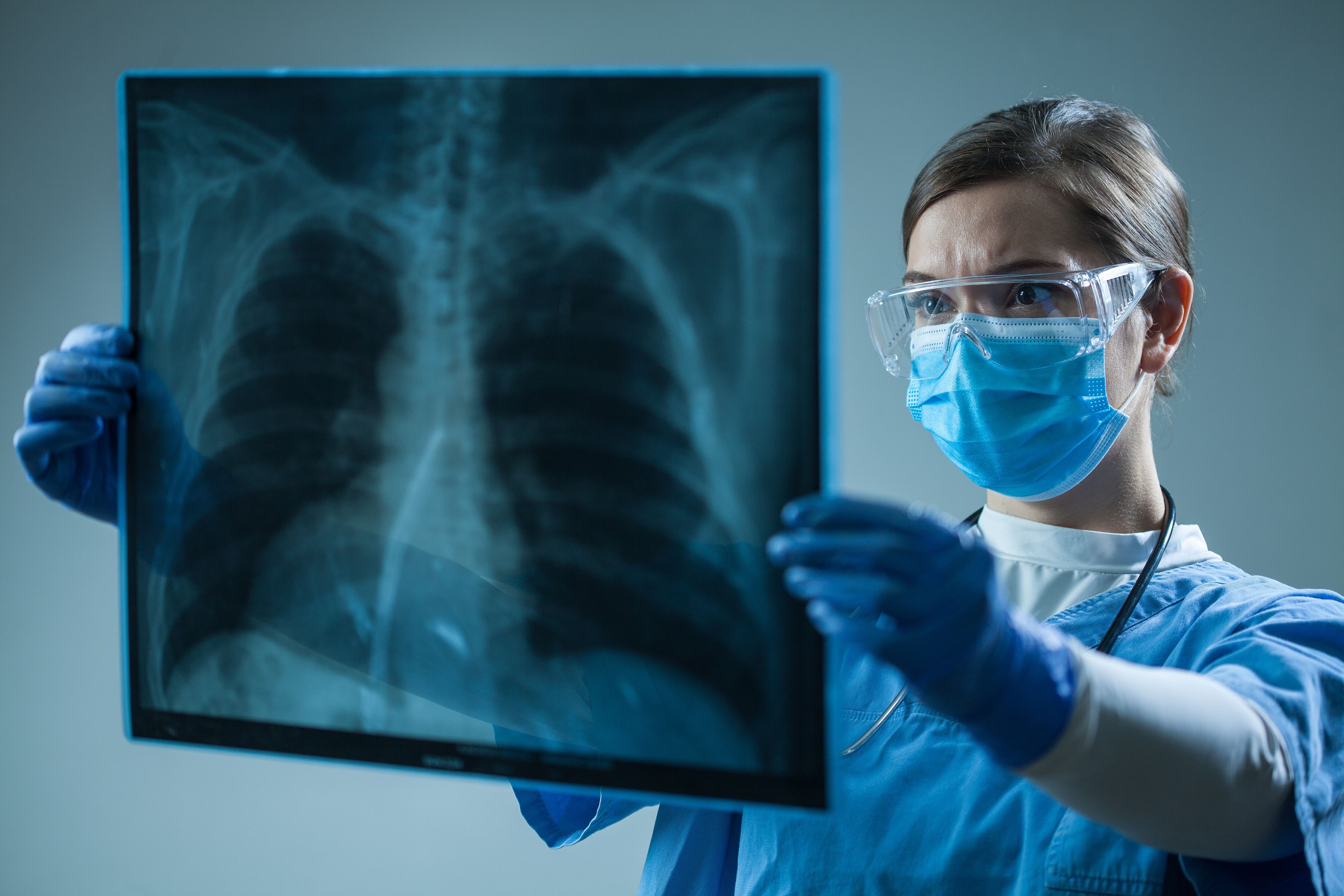 Oncóloga revisando una radiografía (Shutterstock)