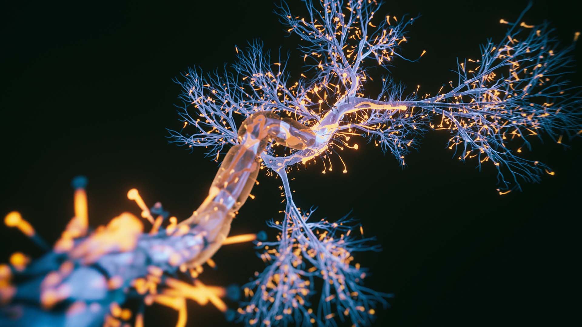 Fotos Cerebro Alzheimer
