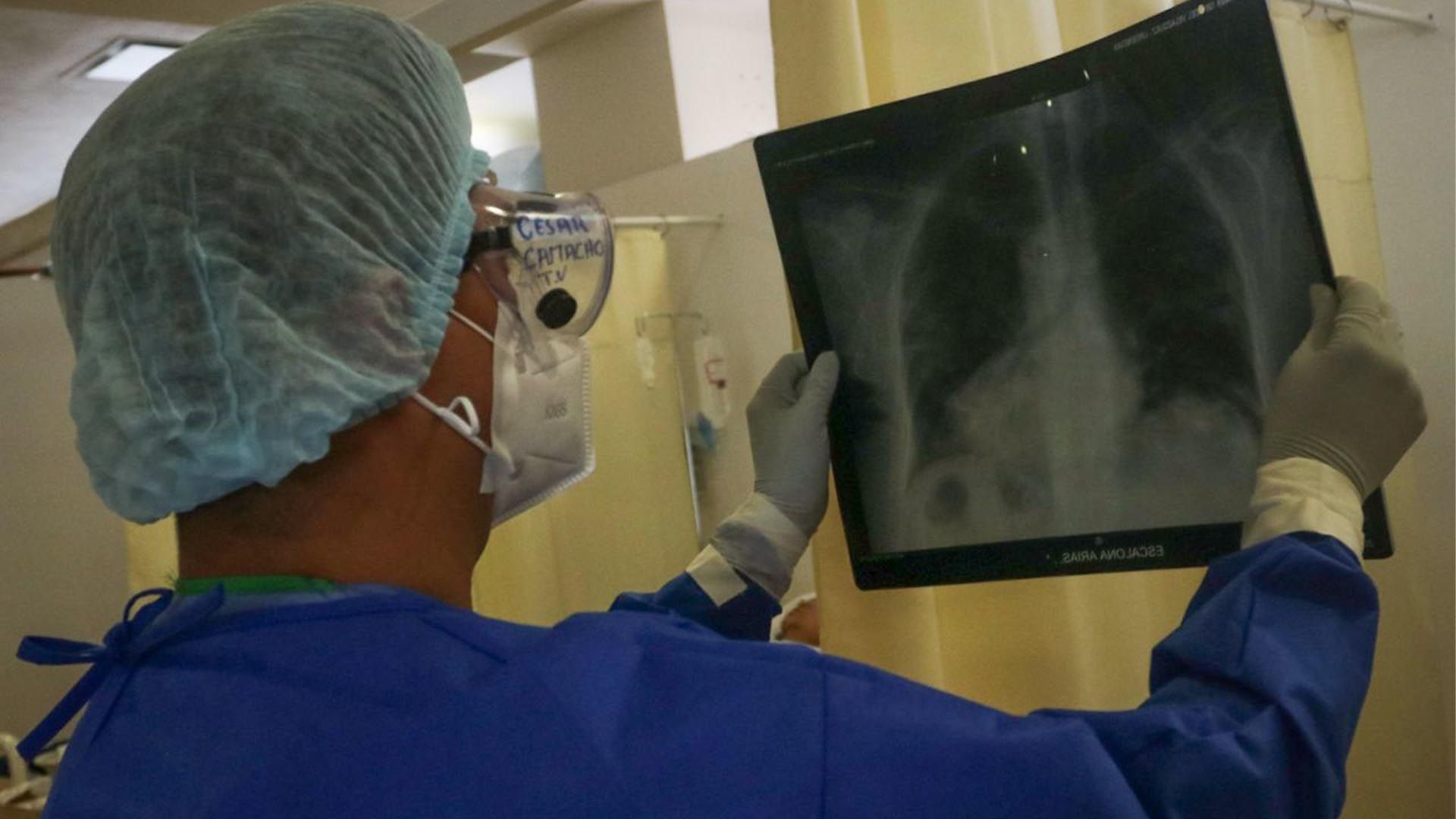 Un médico revisa la radiografía de una paciente. Hoy la IA lo hace ne forma más rápida y eficaz (Foto: Cuartoscuro)