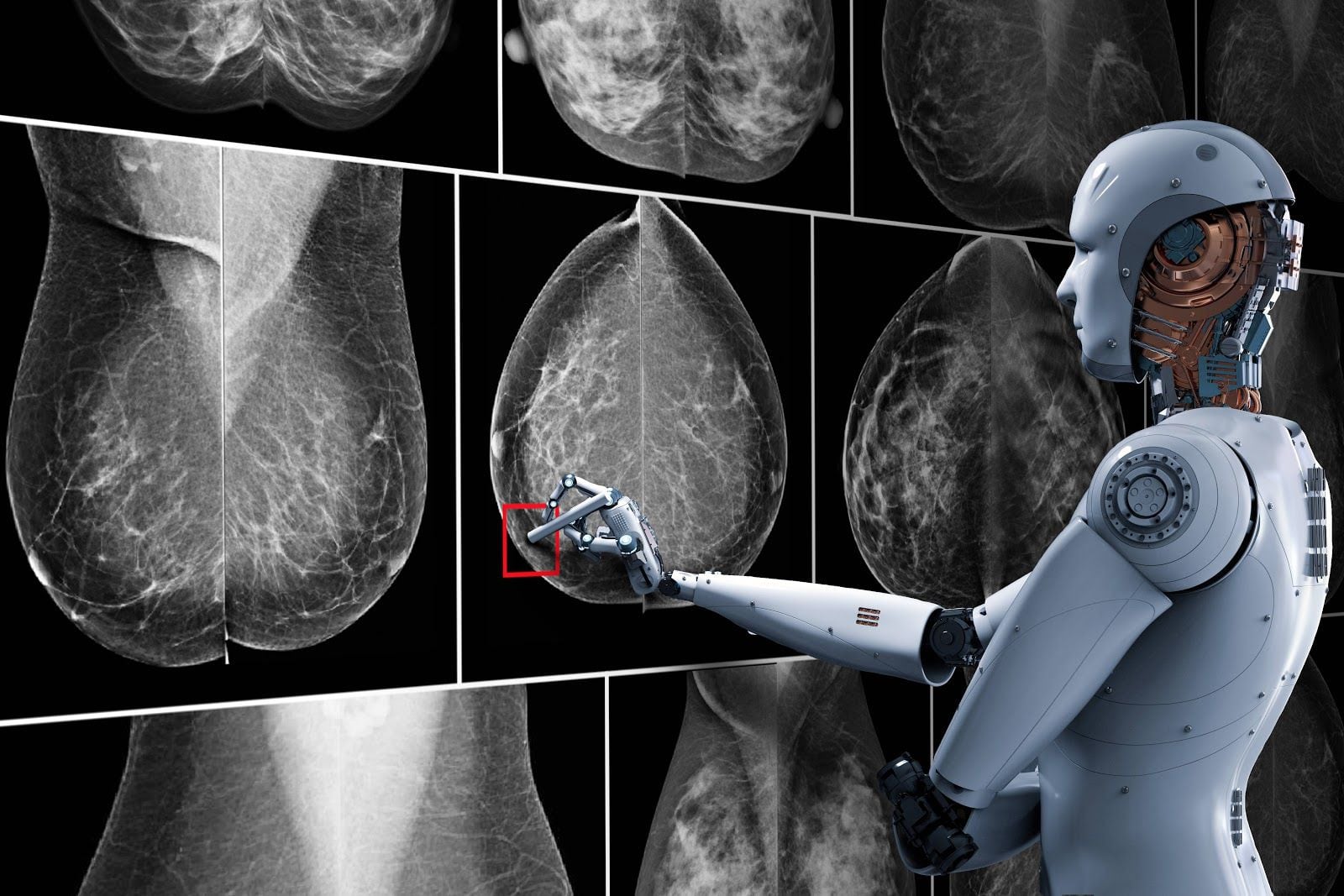 La IA en mamografías puede revolucionar la lucha contra el cáncer de mama
(foto: El Chapuzas Informático)