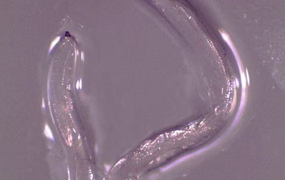 Uno de los gusanos extraídos del ojo de la mujer de 26 años. (Fotografía: folleto de los CDC/Reuters)