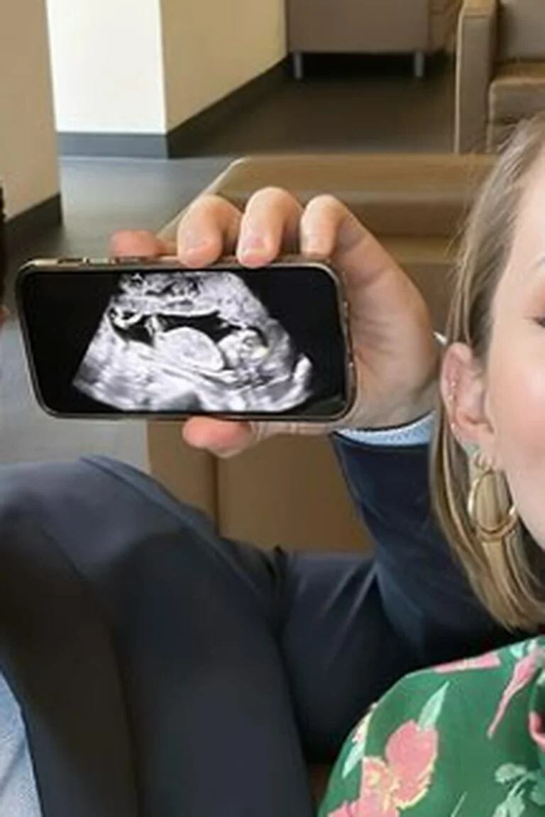 Ya es posible escuchar los latidos del bebé a través del móvil
