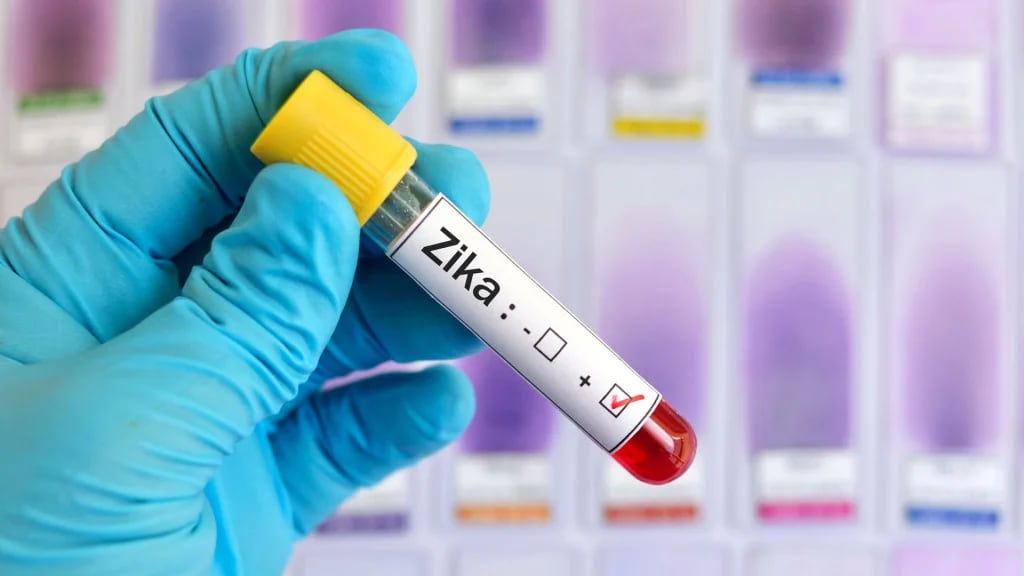 Entre el contagio y la aparición de los síntomas del Zika puede pasar entre 2 y 7 días (Shutterstock)