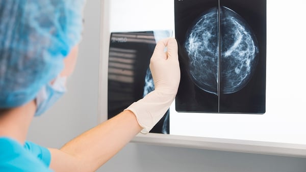 El cancer de mama es una de las principales razones por las que mueren miles de mujeres al aÃ±o (Getty Images)