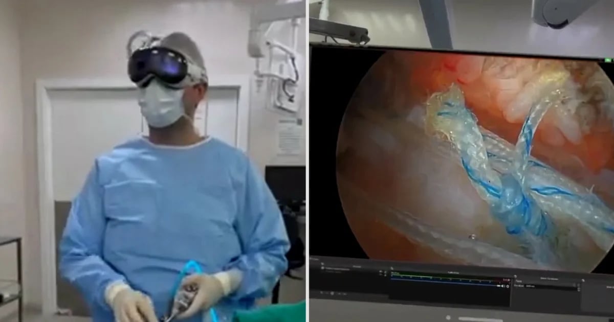 They operated on a shoulder injury using Apple Vision Pro glasses, and this was the result with VR