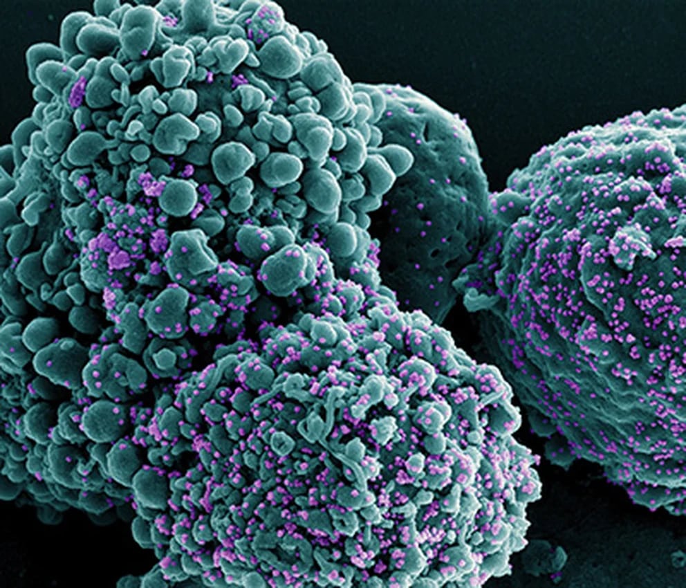  Célula infectada con el coronavirus ómicron (en violeta), observada en un microscopio electrónico (National Institute o 