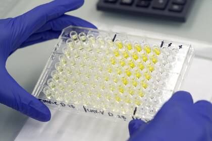 Muestras de COVID-19 son analizadas en un laboratorio de Berlín - REUTERS/Arnd Wiegmann