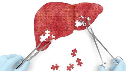 El hígado es un órgano muy noble, que puede seguir trabajando a pesar de estar muy dañado (Shutterstock)