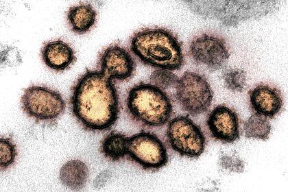 Una imagen de microscopía que muestra al virus SARS-CoV-2 (NIAID-RML/Handout via REUTERS)
