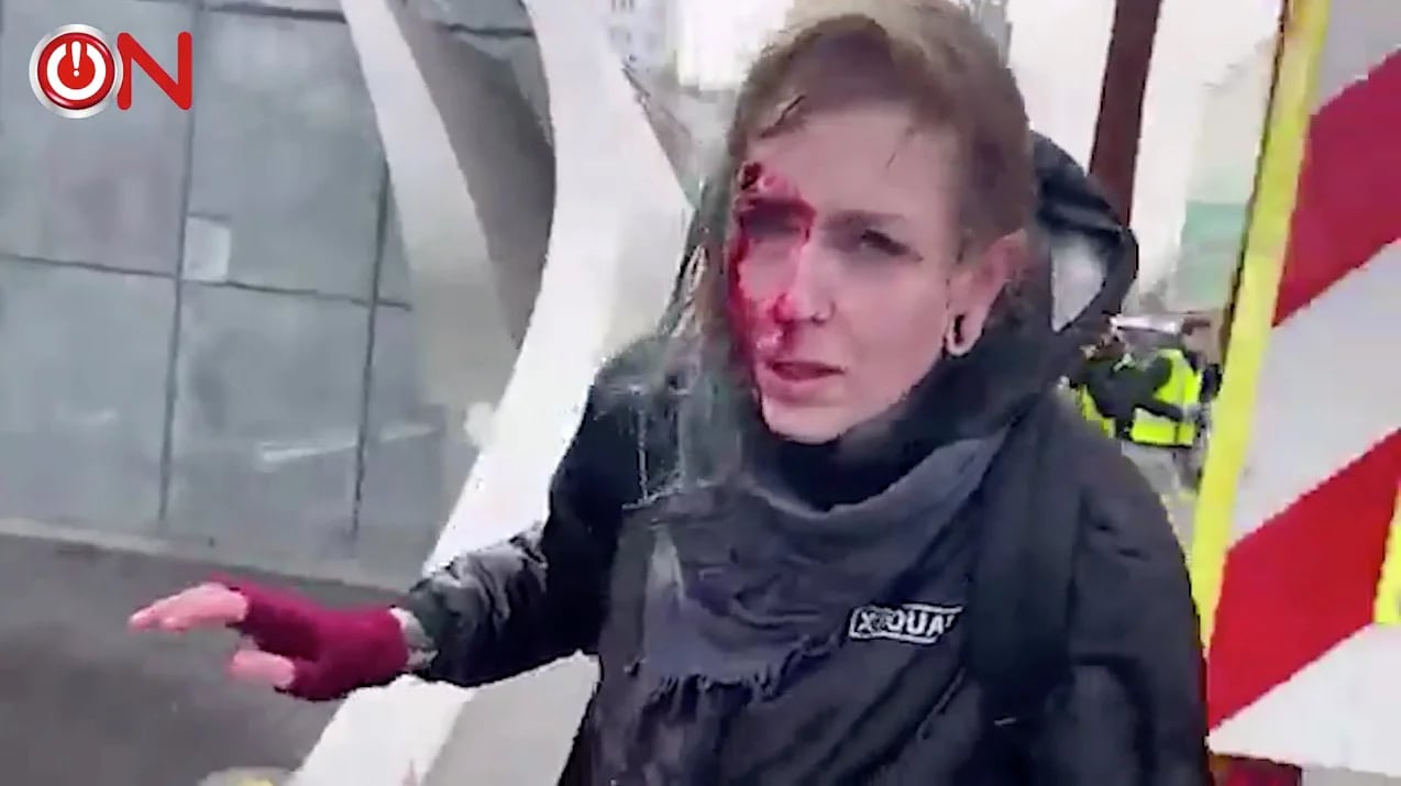 Una mujer herida tras ser aplastada contra el hormigón por un cañón de agua en Eindhoven, el 24 de enero (Ongehoord Nederland/Handout via REUTERS)