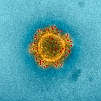 Imagen del virus del MERS