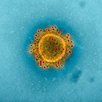 El SARS-CoV-2 visto en un microscopio electrónico (NIAID via The New York Times) -- 