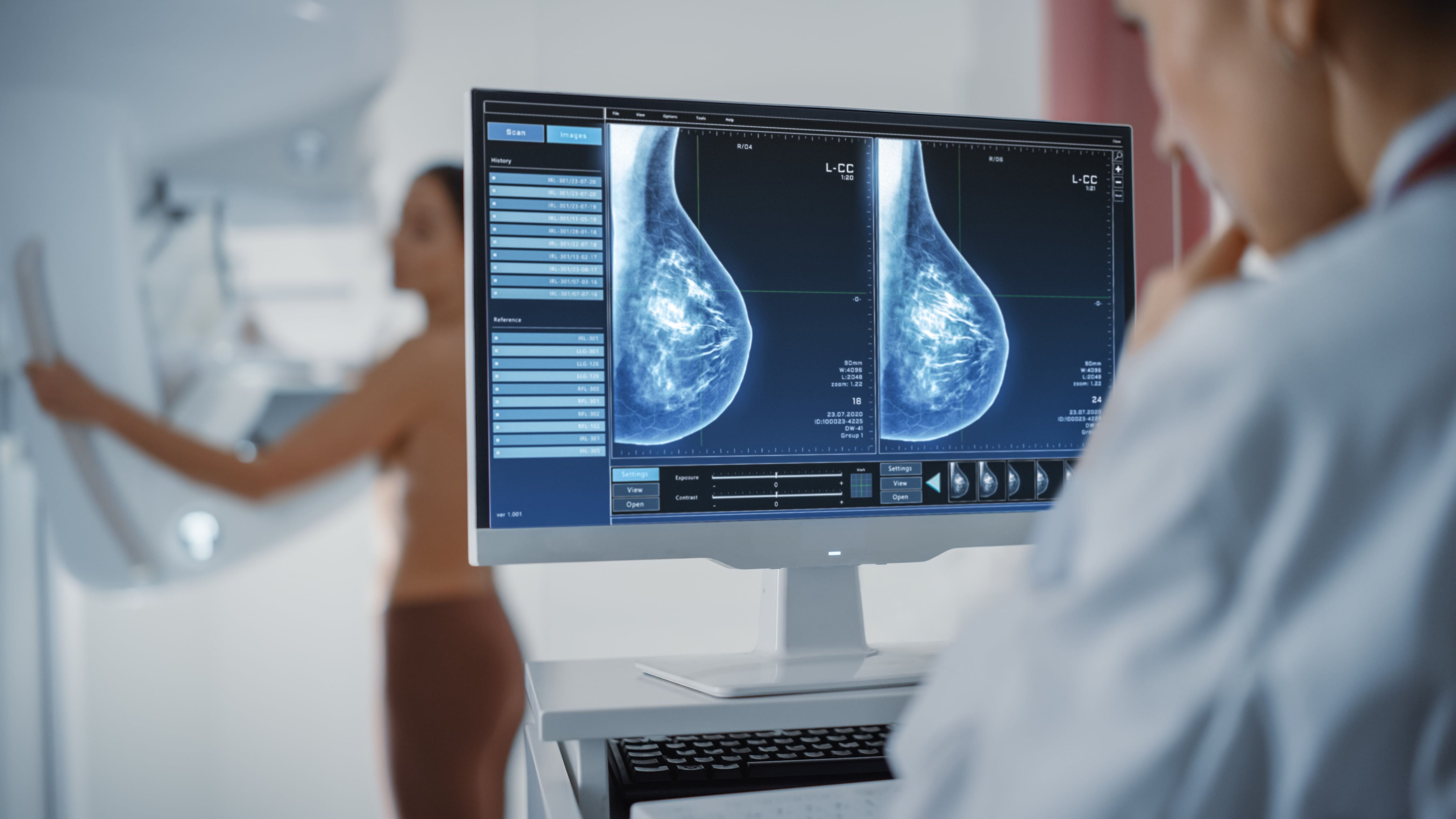 Doctora observando una mamografía (Shutterstock)