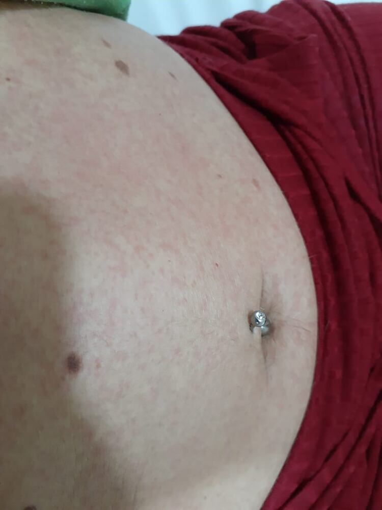 Así se manifiesta el 