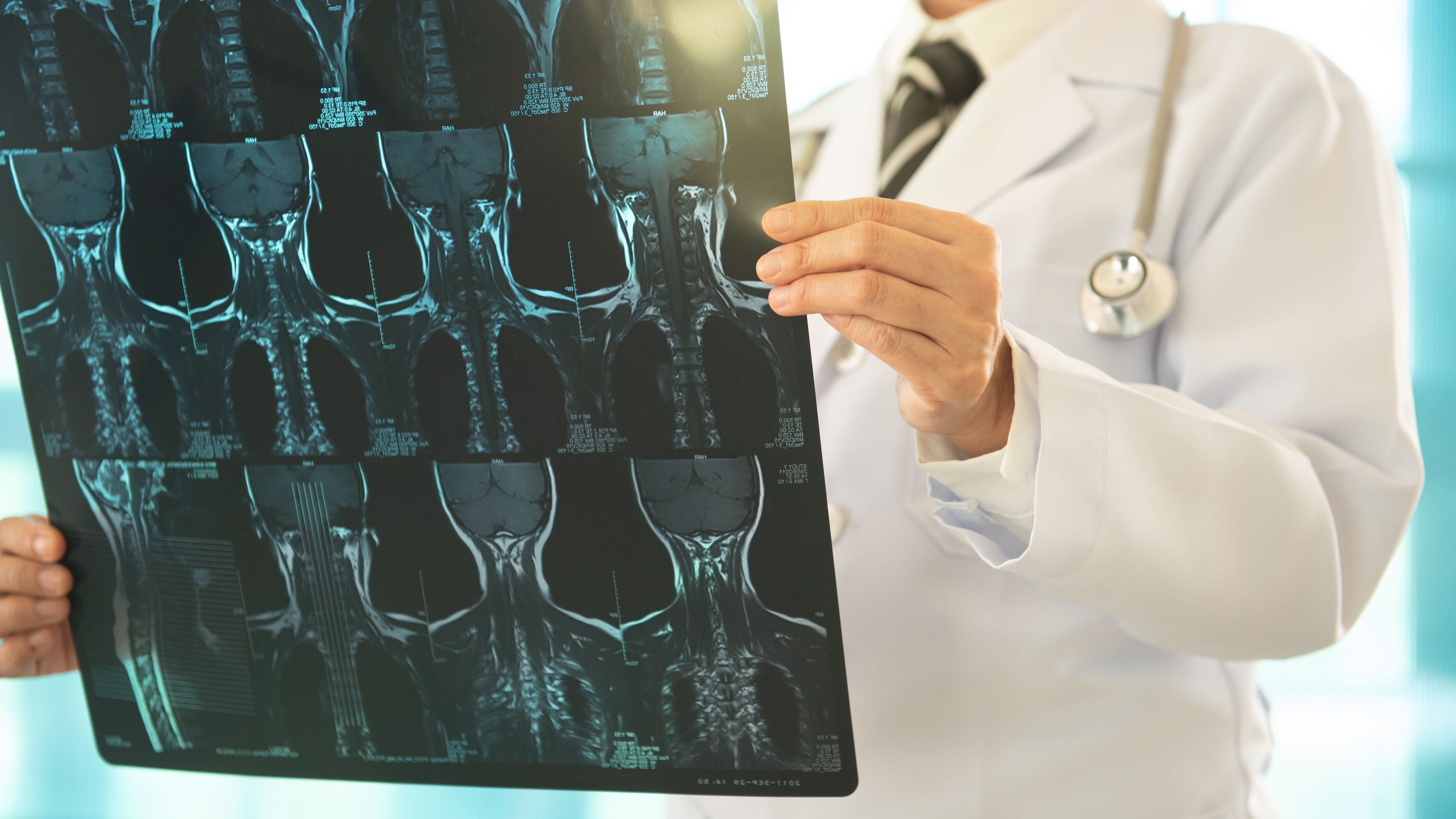 Radiografía de cuello (Shutterstock)
