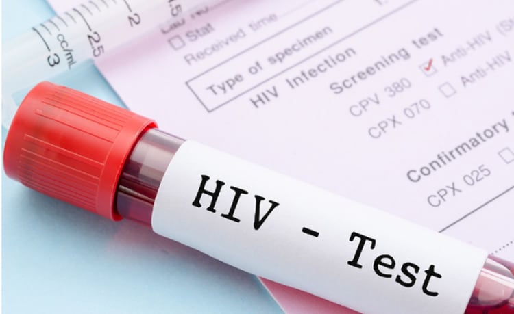 Actualmente existe un análisis de VIH que da el resultado en menos de dos minutos.